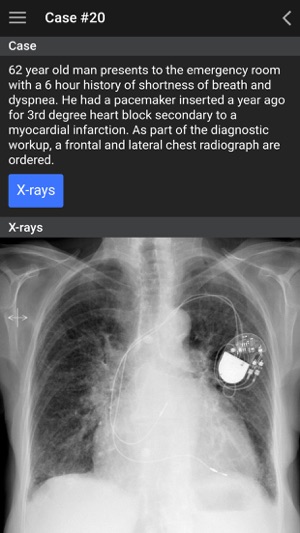 UBC Radiology(圖4)-速報App