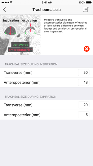 Clinical Imaging Calculator(圖3)-速報App