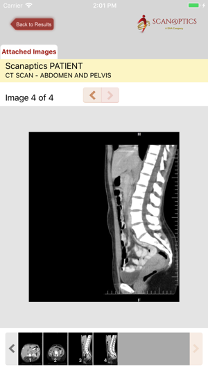 Scanaptics Patient Access(圖5)-速報App