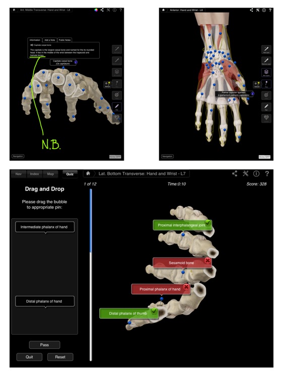 Hand & Wrist Pro III for iPad screenshot-3