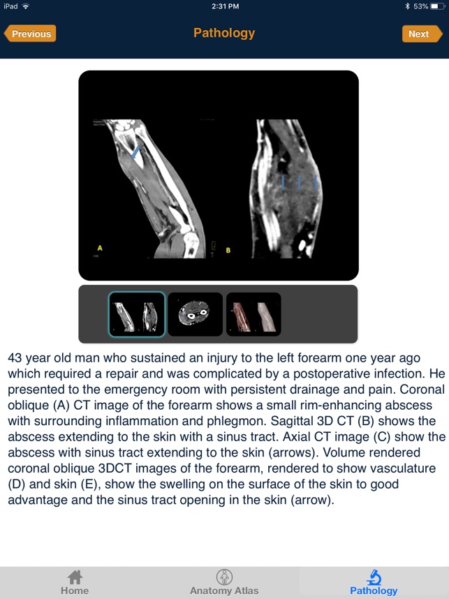 CTisus: CT of the Hand & Wrist(圖5)-速報App