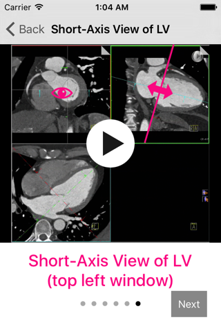 Cardiac Imaging Planes 1-2-3 - náhled