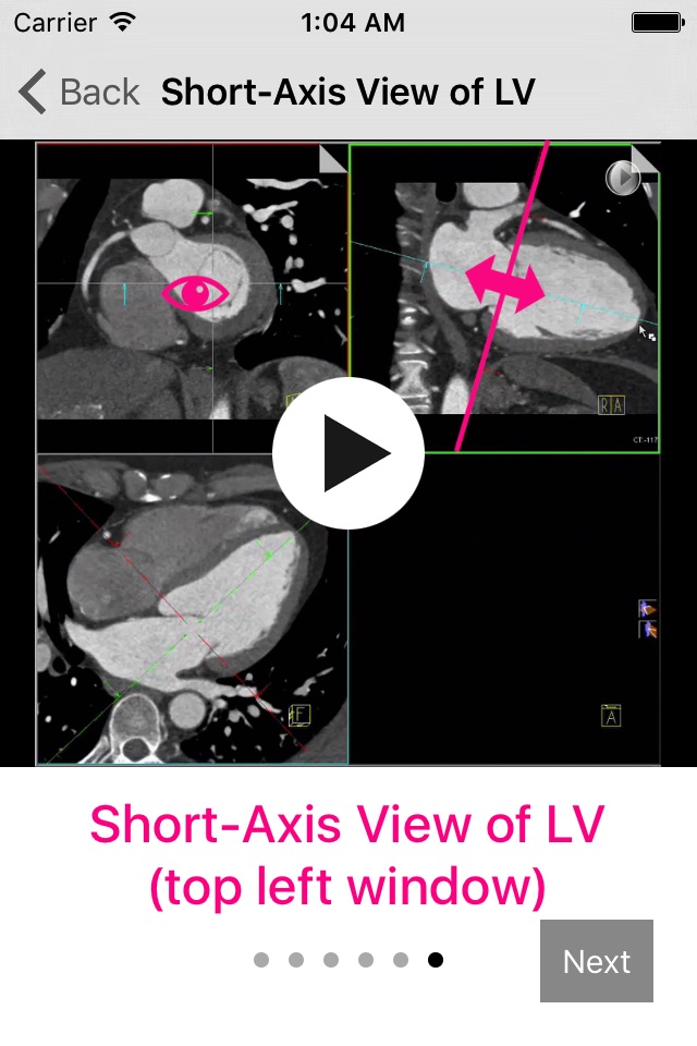 Cardiac Imaging Planes 1-2-3 screenshot 4