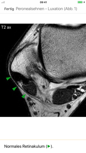 MRI-Essentials(圖6)-速報App