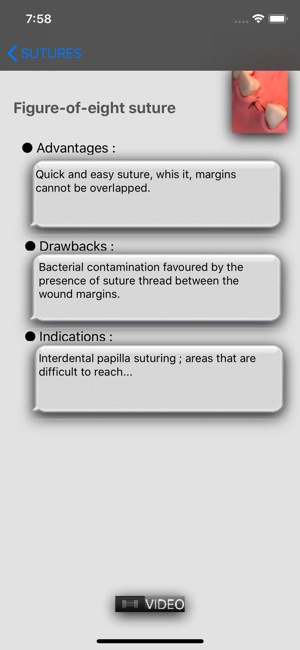 Suturing techniques Videos(圖1)-速報App