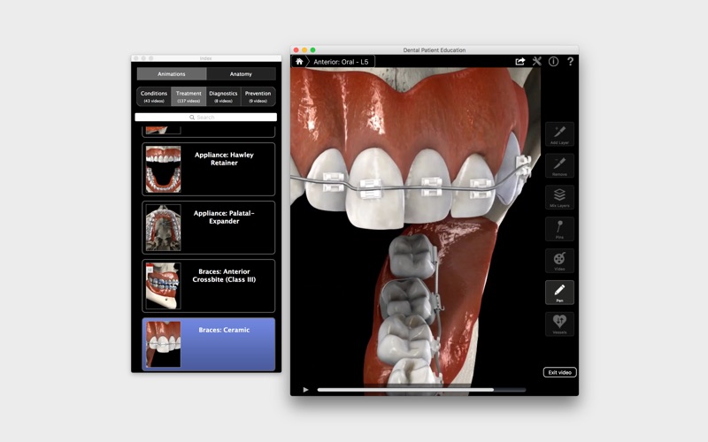 Dental Patient Education screenshot1