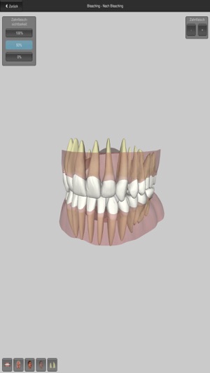 CGM Dental Consult(圖2)-速報App