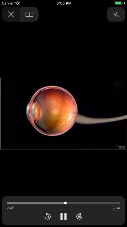 Ocular Eye screenshot-7
