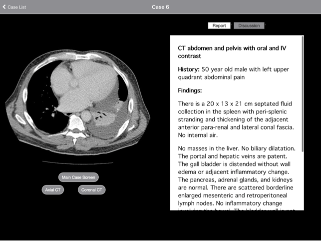 Radiology 2.0: Cases from the End of the World(圖3)-速報App