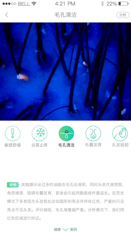 护发AI检测 screenshot-3