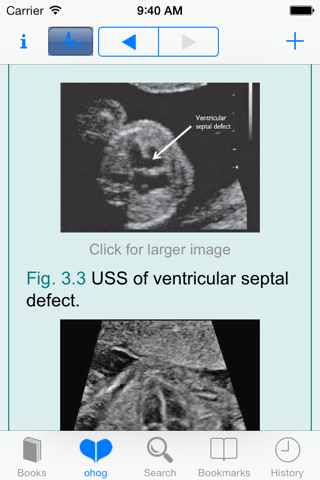 OHB of Obstetrics &Gynaecology screenshot 3