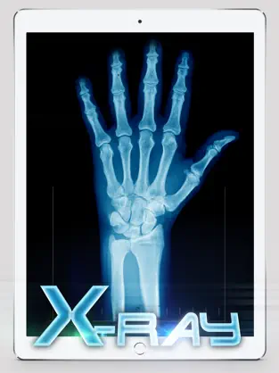Captura 3 Best X-Ray iphone