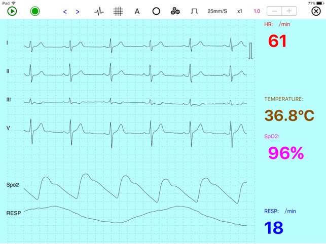 UltraLS HD  ECG SpO2 TEMP