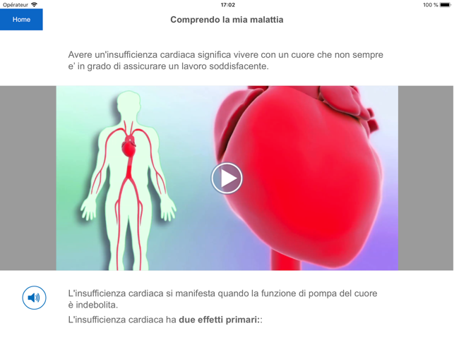 Insufficienza cardiaca(圖2)-速報App