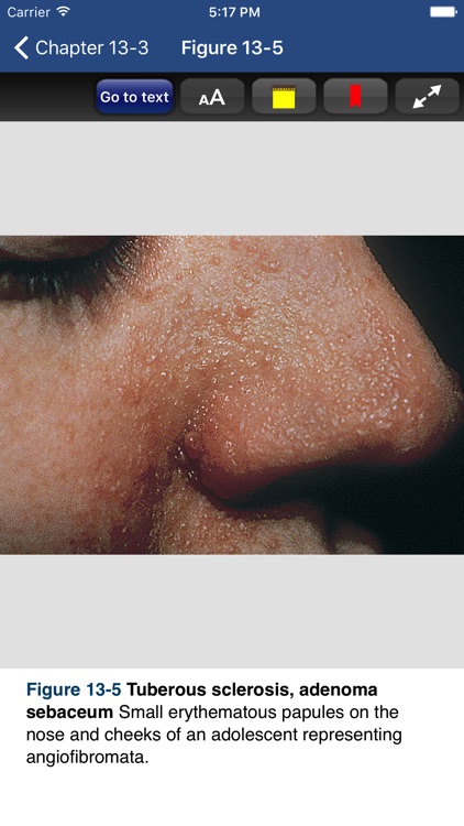 Atlas & Synopsis of Ped. Derm. screenshot-3