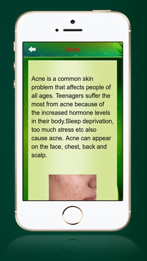 Aloe Vera Benefits !(圖4)-速報App