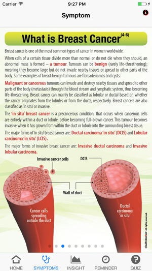 Signs & Symptoms Breast Cancer(圖2)-速報App