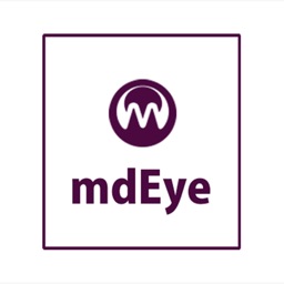 mdeye