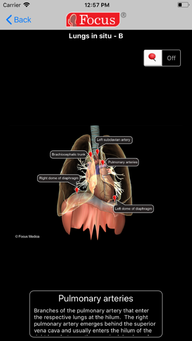 How to cancel & delete LUNGS - Digital Anatomy from iphone & ipad 4