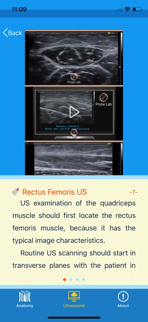 MSK Ultrasound: Thigh(圖3)-速報App