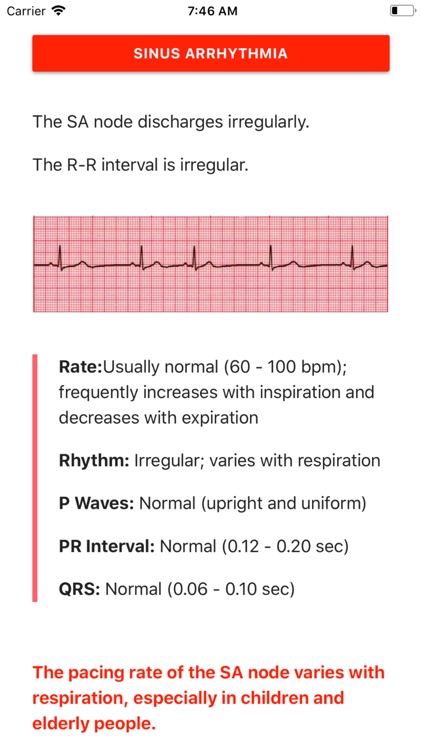 ECG FlashCards