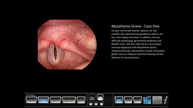 Vocal Pathology: Neurological(圖2)-速報App