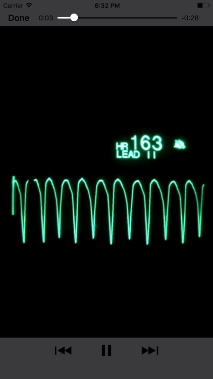 EKG Clinical screenshot-4