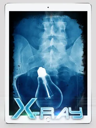 Captura 2 Best X-Ray iphone