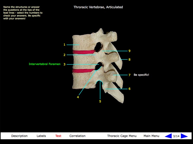 Gross Anatomy of the Skeleton screenshot-3