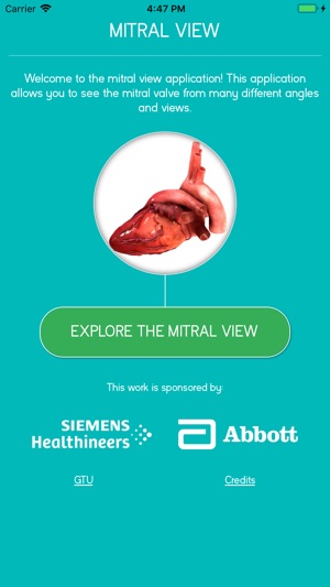 Mitral View