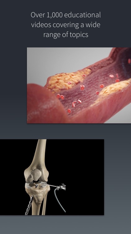 Complete Anatomy 19 for iPhone screenshot-5