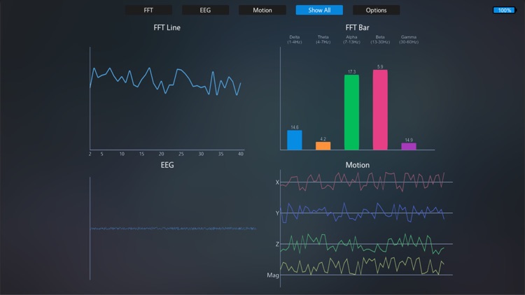 NeuroPlus: My Brain