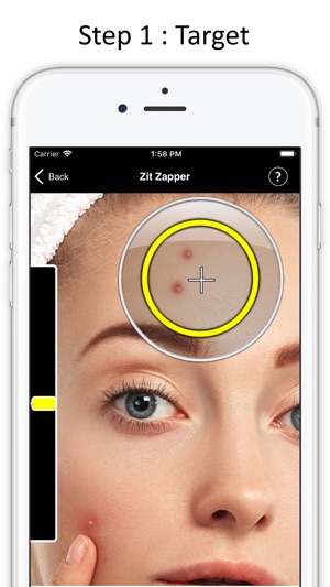 Zit Zapper - Remove Pimples(圖2)-速報App