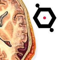 ION Brain Slice Viewer pour PC