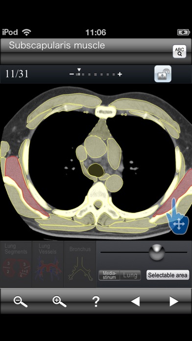 Chest CT Sectional Wa... screenshot1