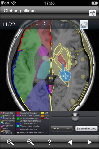 Brain MRI Sectional Walkerのおすすめ画像1