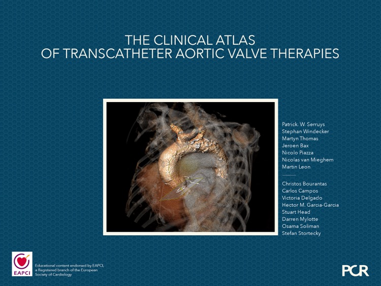 PCR Valve Atlas