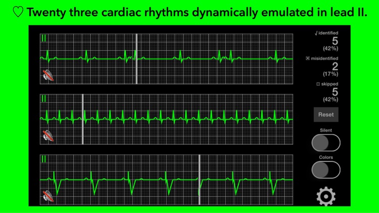 arrhythmia screenshot-0