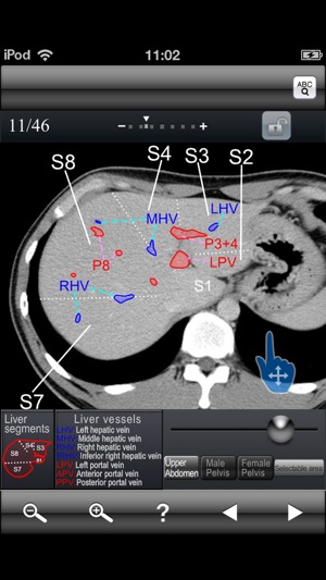 Abdominal CT Sectional Walker(圖2)-速報App