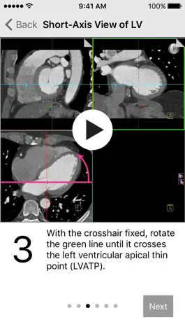 Game screenshot Cardiac Imaging Planes 1-2-3 mod apk