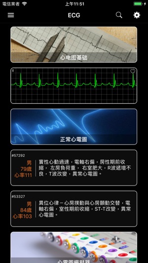 ECG - 海量心電圖案例和診斷詳解