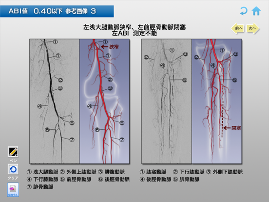 末梢動脈3Dアトラスのおすすめ画像3
