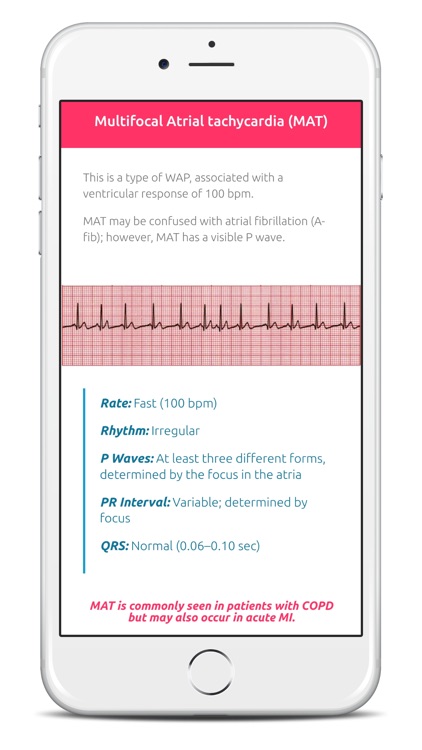ECG FlashCards Pro screenshot-3