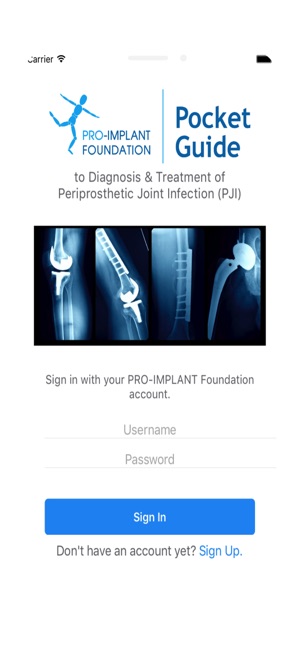 PRO-IMPLANT Pocket Guide