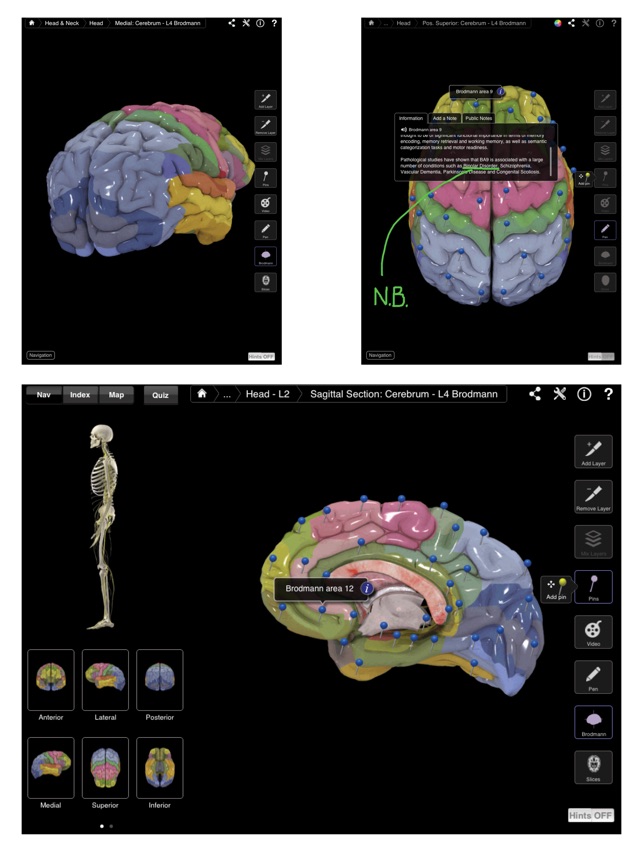 Brain & Nervous System Pro III(圖5)-速報App