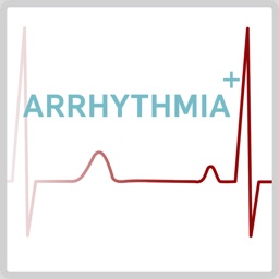 Arrhytmia AR