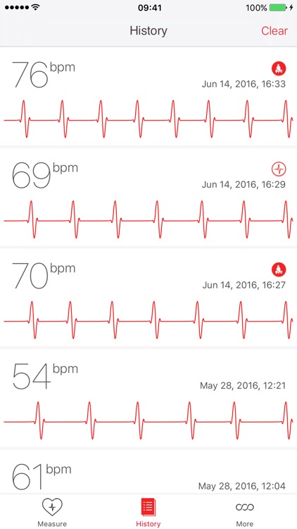 Cardiograph