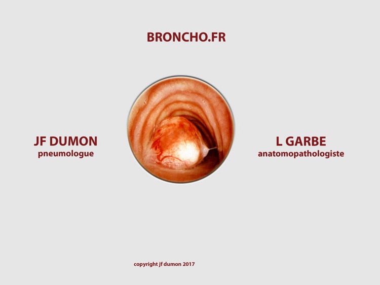 BRONCHO+.fr by jf.dumon