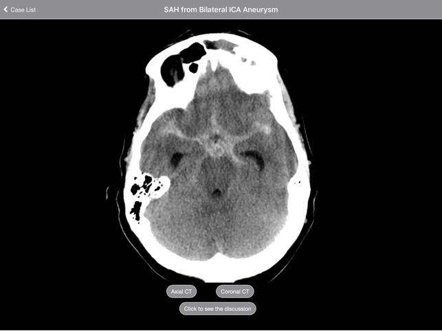 Radiology 2.0: Head CTs(圖3)-速報App