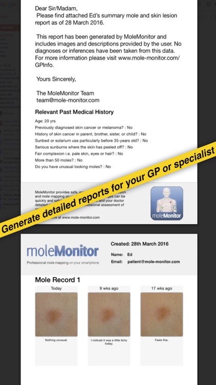 Mole Monitor screenshot-4
